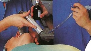 Трудная интубация. Трудный дыхательный путь.