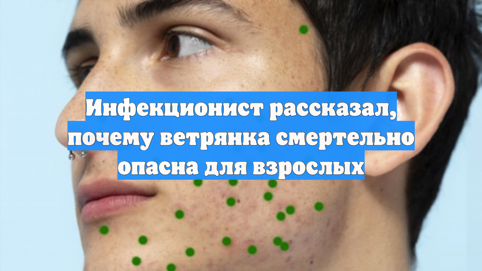 Можно Заниматься Сексом При Ветрянке Можно Заниматься Сексом При Ветрянке