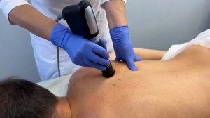 Ударно-волновая терапия_ что это такое и как работает