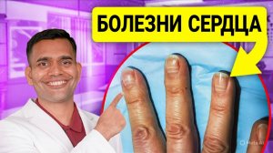 5 ПРИЗНАКОВ СЕРДЕЧНЫХ ЗАБОЛЕВАНИЙ, КОТОРЫЕ ВЫ МОЖЕТЕ ЗАМЕТИТЬ | ДОКТОР ВИВЕК