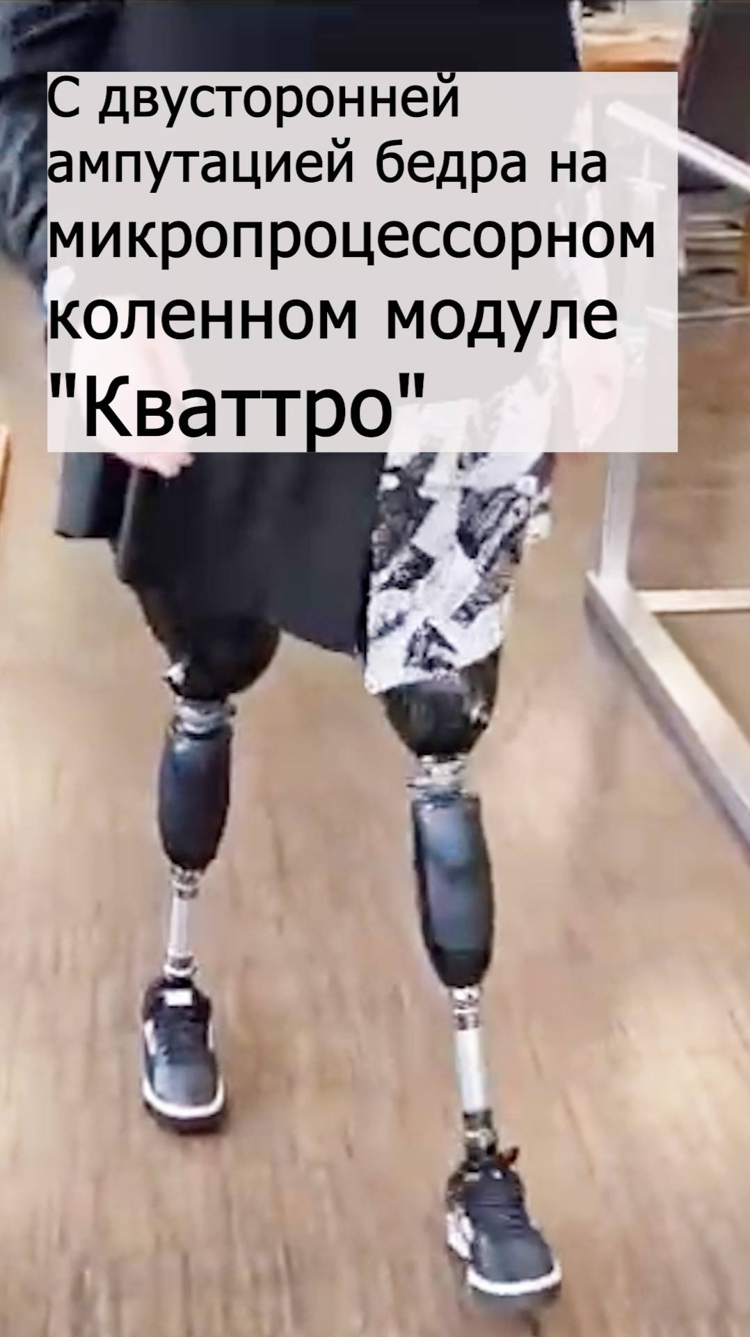 С двусторонней ампутацией бедра на микропроцессорном коленном модуле "Кваттро" смотреть онлайн