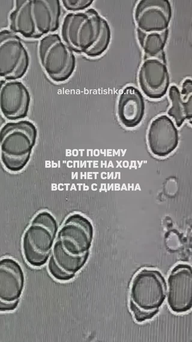 Вот почему вы "спите на ходу" и постоянно нет сил. Семейный доктор Алена Братишко смотреть онлайн