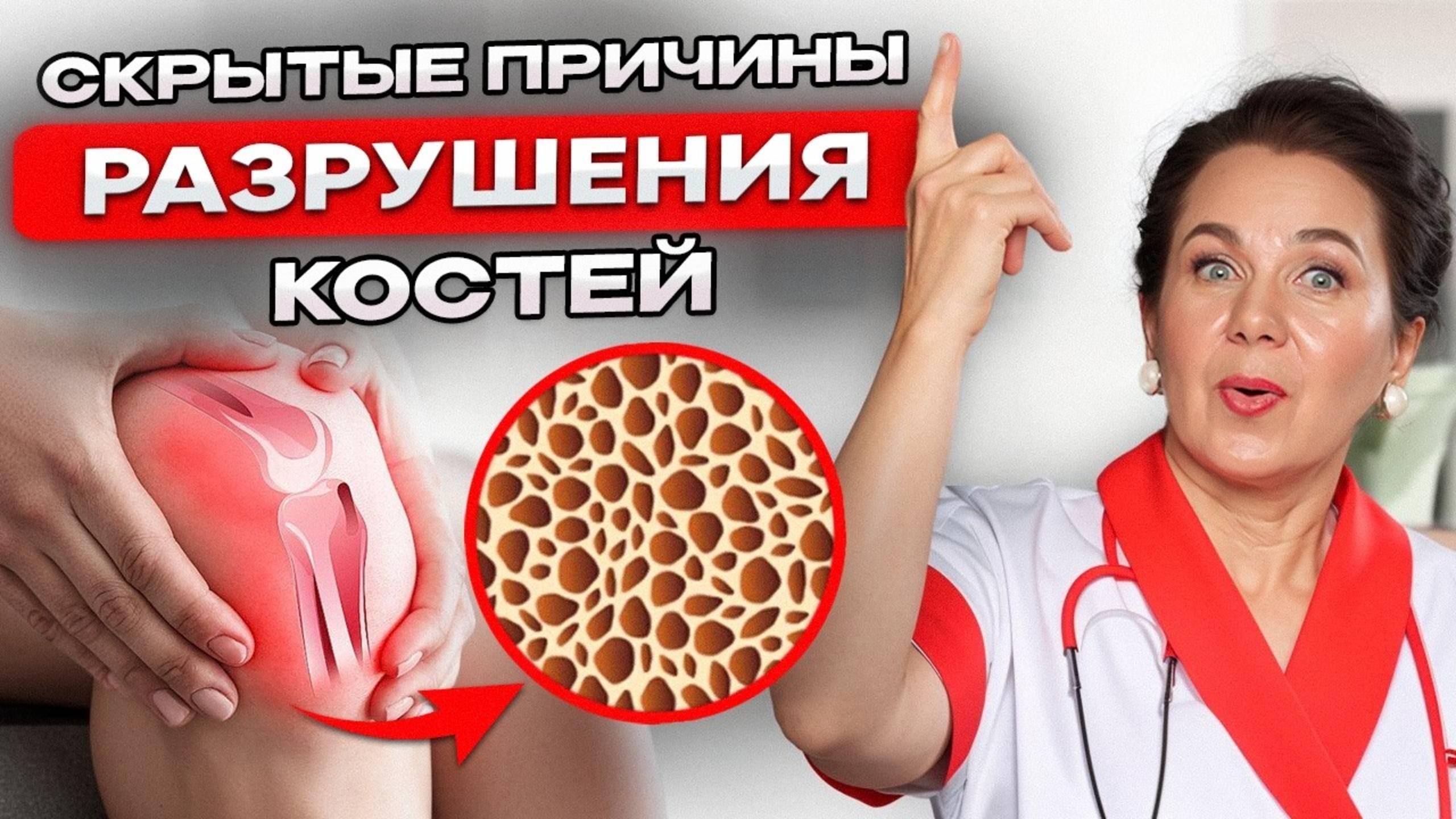 ОСТЕОПОРОЗ: Как не рассыпаться после 45 лет? Причины, симптомы и методы укрепления костей смотреть онлайн