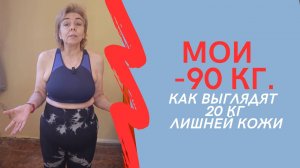 МОИ МИНУС 90 кг. Как выглядит 20 кг. лишней кожи?