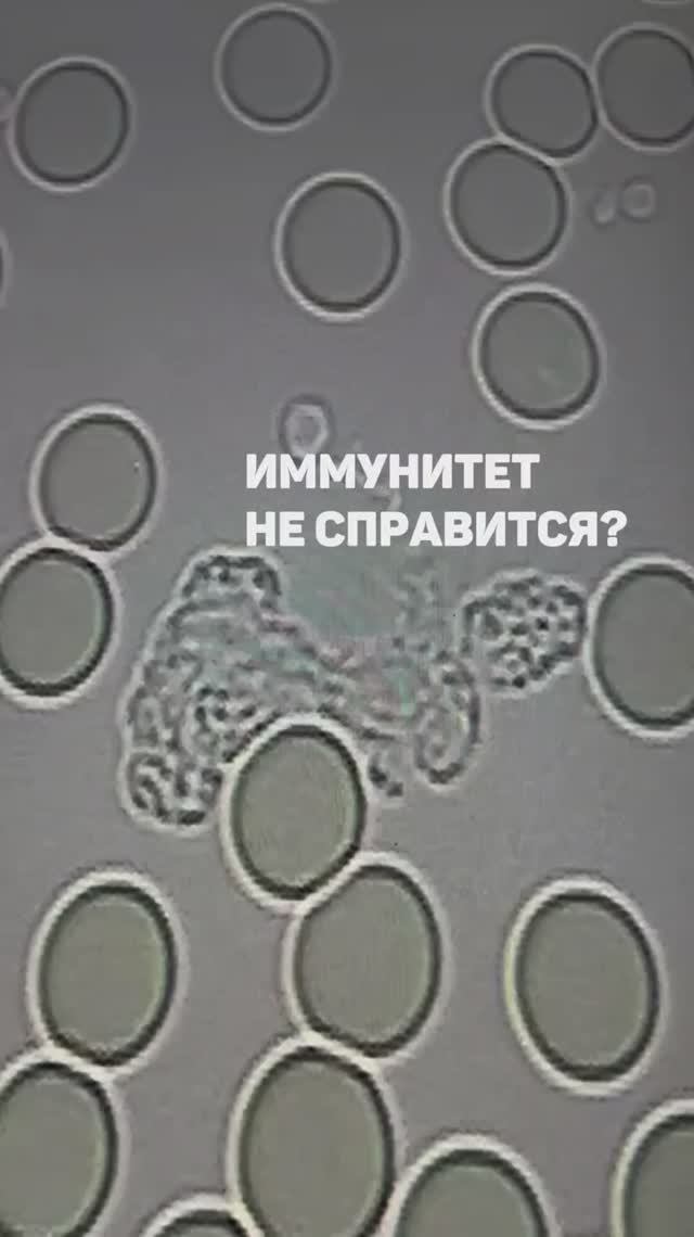 Может ли естественный иммунитет справиться с любой инфекцией. Семейный доктор Алена Братишко смотреть онлайн