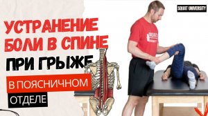 Устранение боли в спине при грыже в поясничном отделе