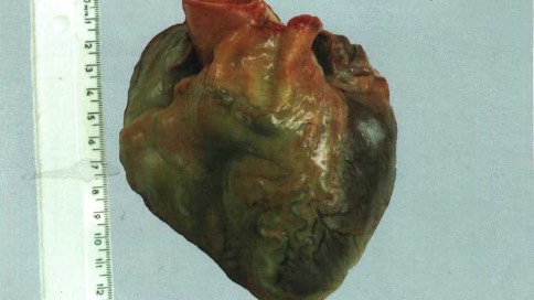 Компенсаторно-приспособительные процессы смотреть онлайн