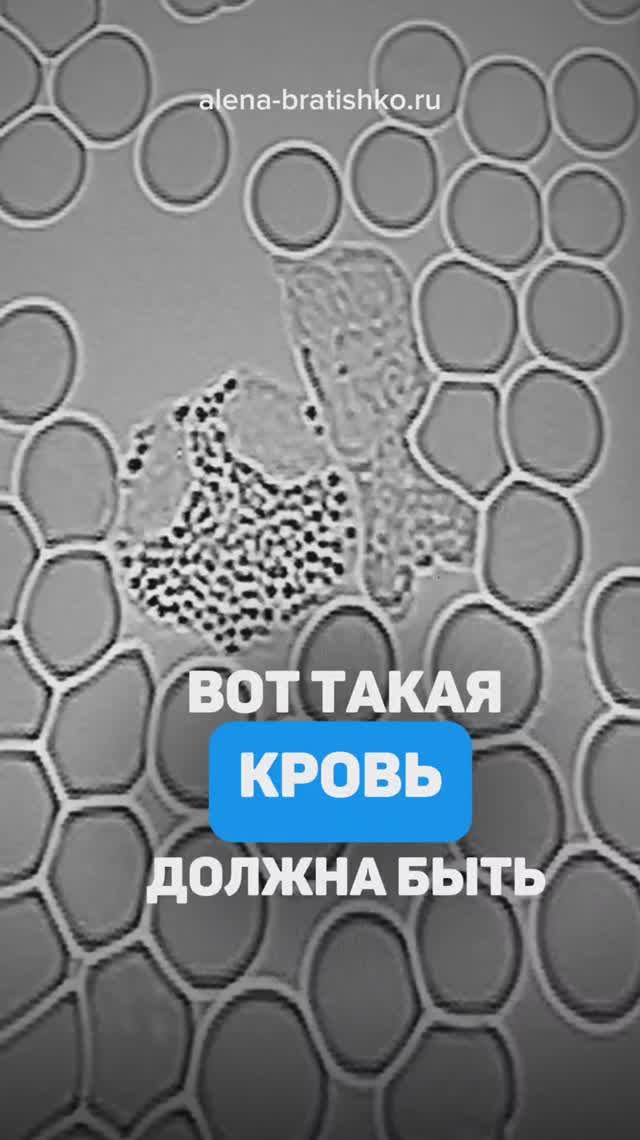 Вот такая кровь должна быть! Алена Братишко, семейный доктор смотреть онлайн