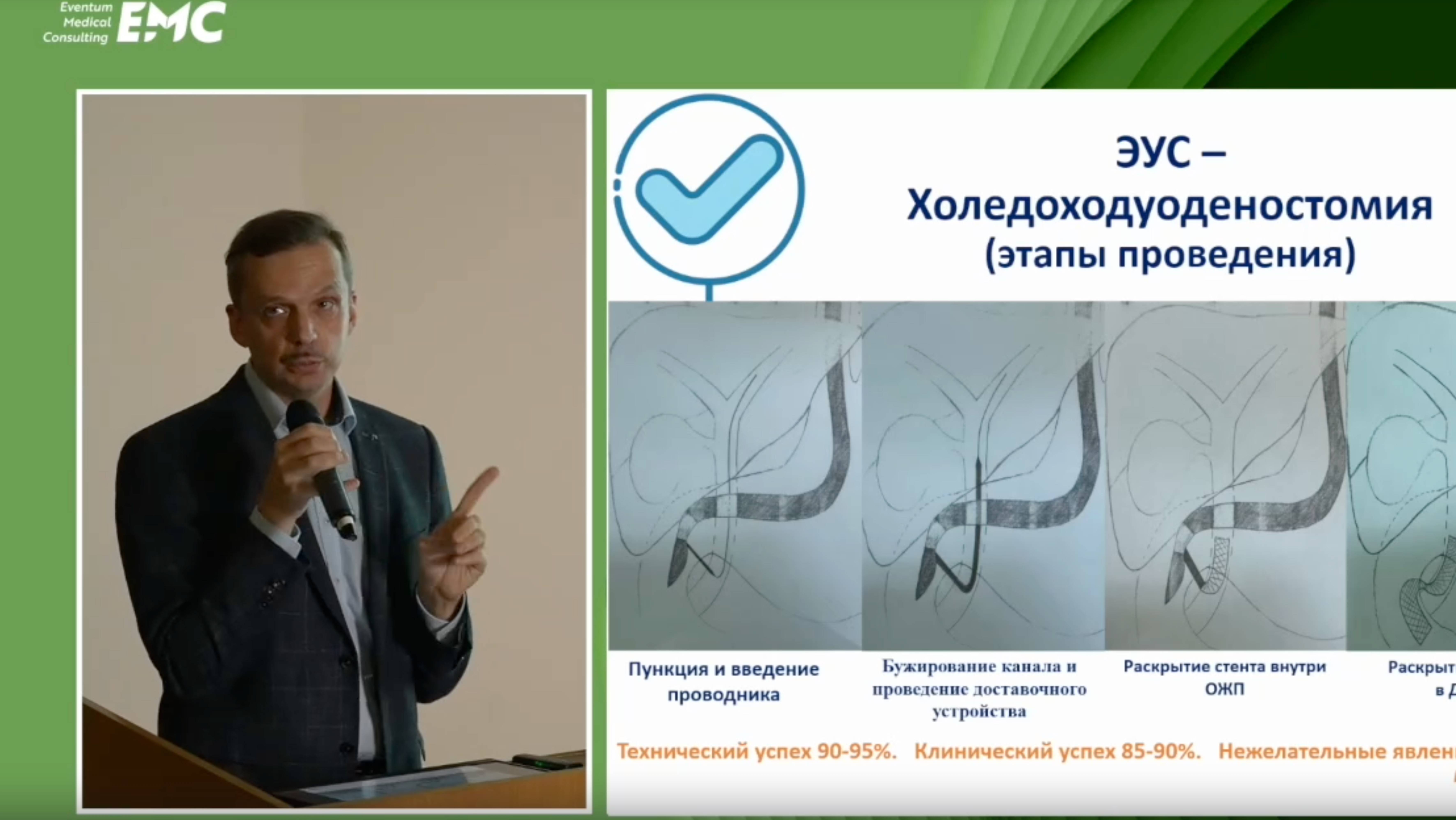 6 Бурдюков МС Интервенционная эндосонография в алгоритме ведения пациентов с механической желтухой