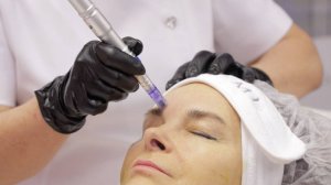 Фракционная мезотерапия. Программа подготовки кожи к агрессивным косметическим процедурам