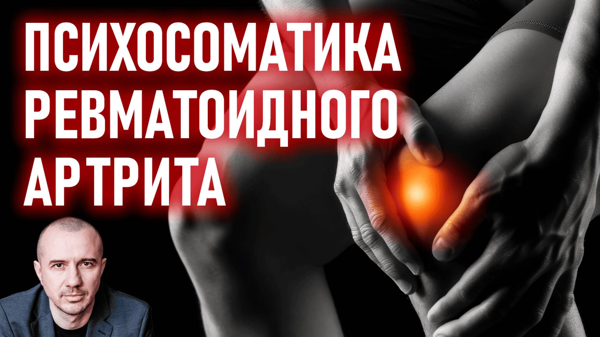 Какие ситуации приводят к ревматоидному артриту. Серопозитивный и серонегативный артрит смотреть онлайн