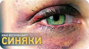 Как возникают синяки? [SLIVKI SHOW]