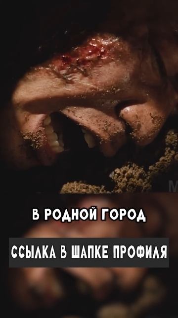 Взрыв повредил его барабанные перепонки, оглушил и обжог четверть тела смотреть онлайн