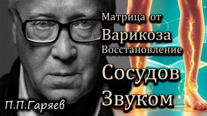 МАТРИЦА ГАРЯЕВА ОТ ВАРИКОЗА | Лечение сосудов без операций | Звуковая терапия для вен