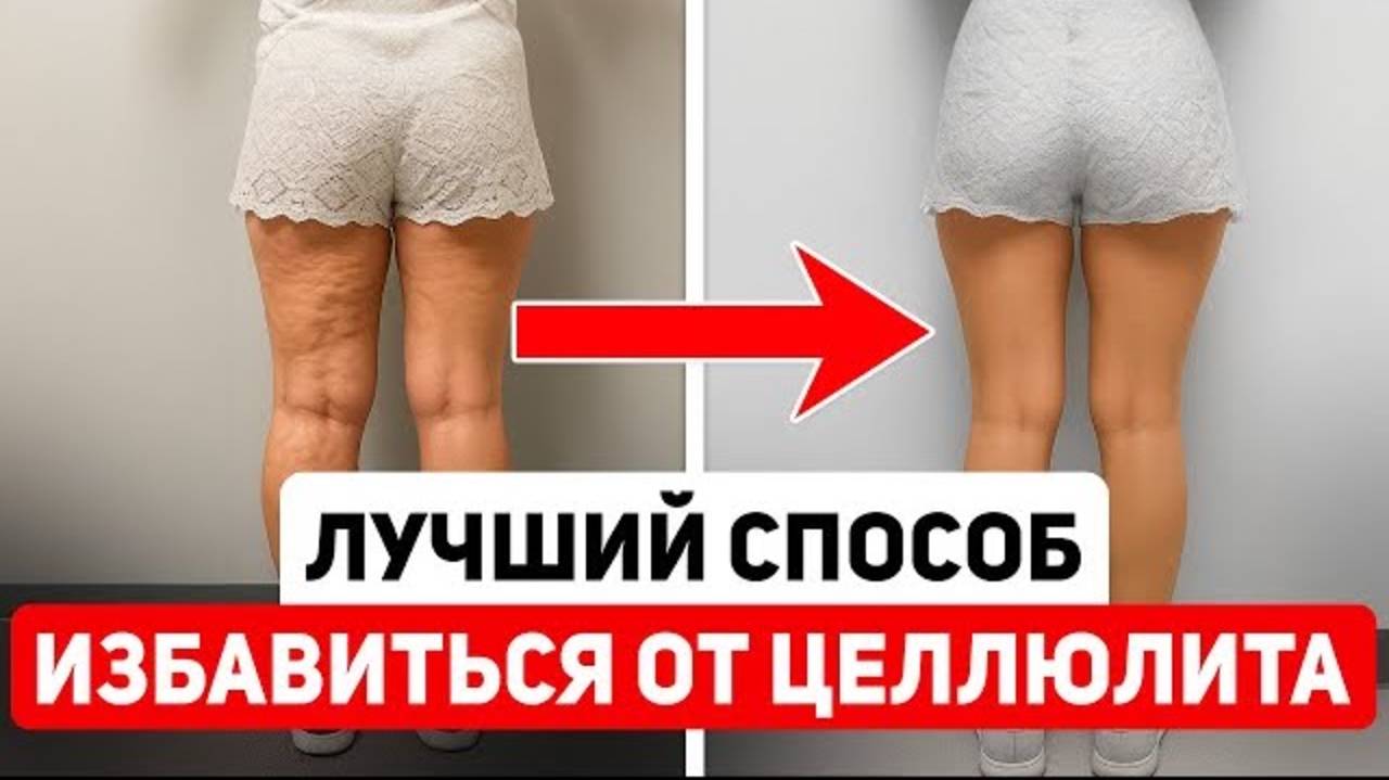 Убираем целлюлит и бока за 7 минут 🔥 Мощный лимфодренажный массаж ложкой или блейдом смотреть онлайн