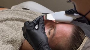 Комплексная чистка лица от косметолога Natural Beauty