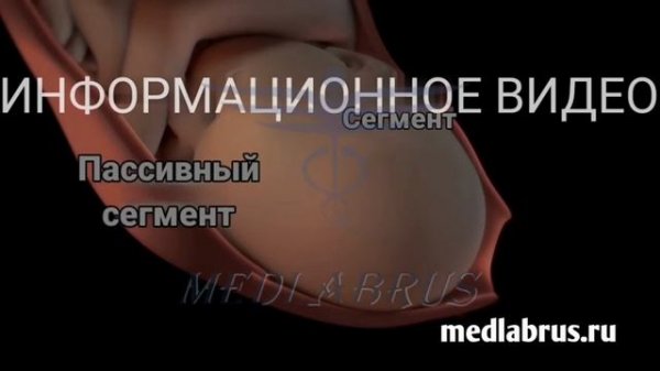 Вагинальные роды-Первая стадия родов: 3D-анимация процесса и симптомы