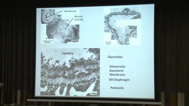 Visualising and reconstructing the glycocalyx - Kenton Arkill 2014