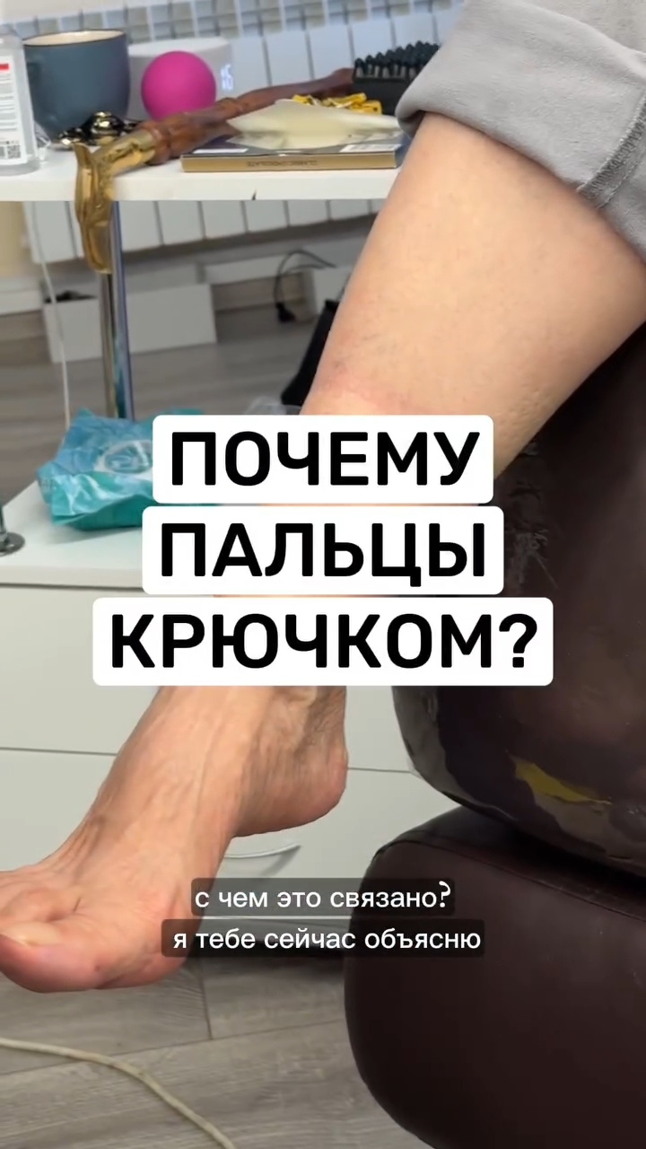 Как исправить молоткообразные пальцы. Востановить правильную геометрию, зафиксировать эту геометрию смотреть онлайн