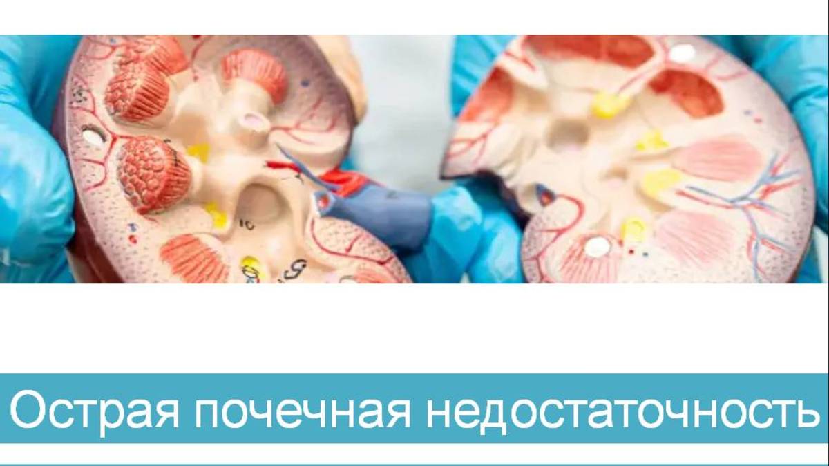Острая почечная недостаточность, Часть 3. Осложнения, проявления и лечение.