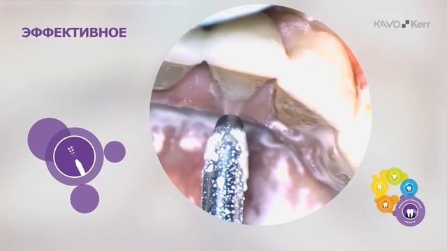 Клинические случаи PROPHYﬂex 4