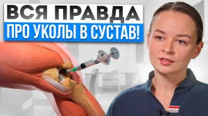 ГИАЛУРОНОВАЯ КИСЛОТА при БОЛЯХ в коленях — ЧУДО или пустая ТРАТА денег? Вся ПРАВДА!