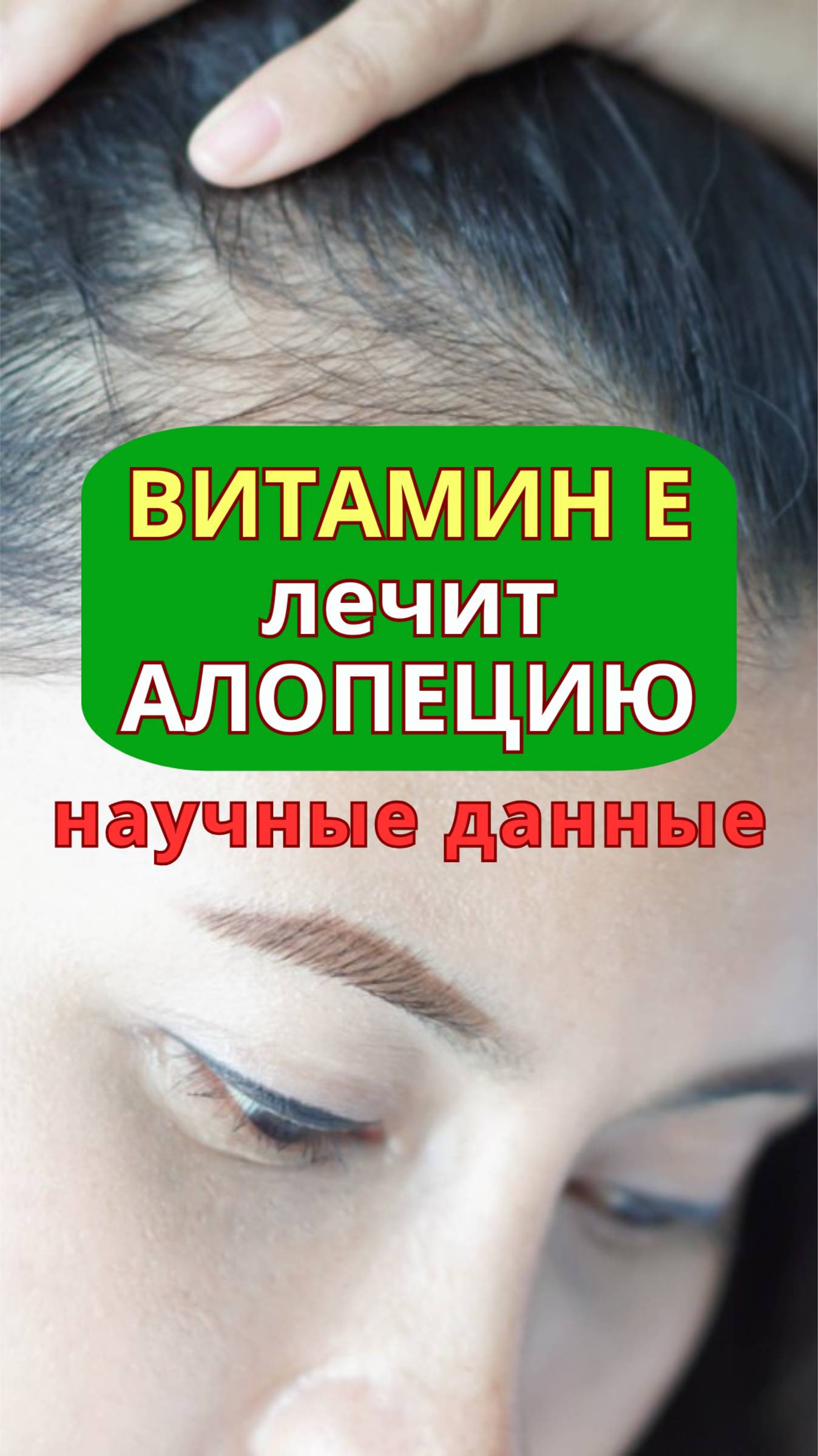 Витамин Е лечит алопецию: научные данные | alopecia.hair