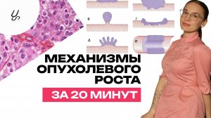 Опухоли, опухолевый рост, механизмы за 20 минут