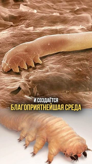 Почему НЕ РАСТУТ ресницы? смотреть онлайн