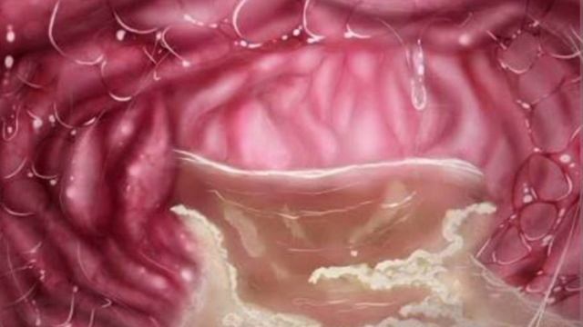 MISIDE VORE / SLEPPY MITA VORE AUDIO смотреть онлайн