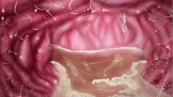 MISIDE VORE / SLEPPY MITA VORE AUDIO