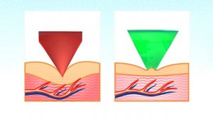 Современный Аппликатор Кузнецова - Тибетский Аппликатор.