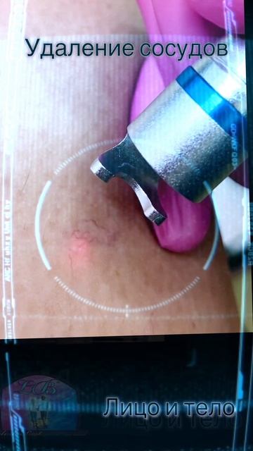 Сосуды… Нужна помощь!?