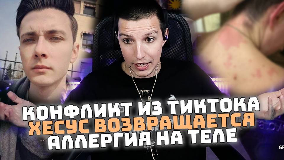Конфликт из ТикТока | Хесус возвращается | Аллергия на теле смотреть онлайн