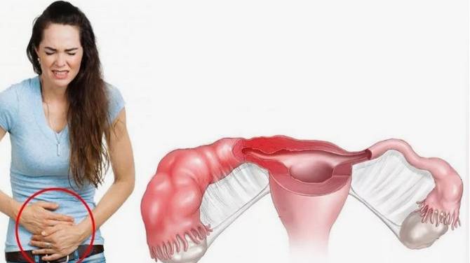 Внематочная беременность причины и лечение смотреть онлайн