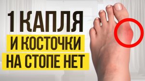 Останови вальгус! Как вернуть подвижность и избавиться от боли в стопах