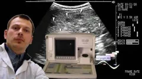 Детское УЗИ брюшной полости - Диссеминированное поражение печени смотреть онлайн