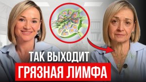 ТОП 5 убийц вашей ЛИМФЫ. Как распознать и БЫСТРО очистить грязную лимфу?