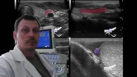 Детское УЗИ щитовидной железы - Близкие друзья смотреть онлайн