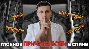 Вот, что на самом деле болит в спине. Забудьте про остеохондроз, грыжи и протрузии