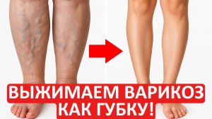 Варикоз и отеки ВЫЖИМАЮТСЯ как губка! | Методика 30-летнего опыта🔥