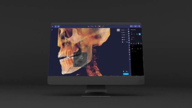 Ray Vision SW — Slice Explorer смотреть онлайн