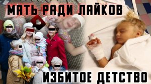 Мать ради лайков. Избитое детство. Москва