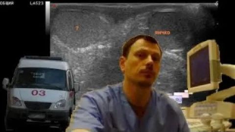 Детское УЗИ мошонки - Фантомное яичко или сперматогенная гранулема смотреть онлайн