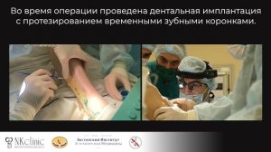 Прорезалась титановая пластина. Операция по восстановлению челюсти