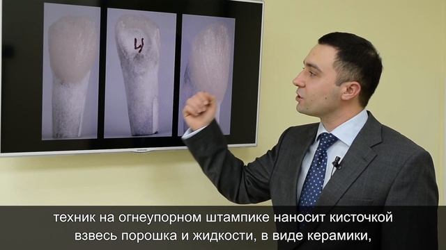 Из чего изготавливают зубные коронки и что такое абатмент? | Блог #2 | NKClinic