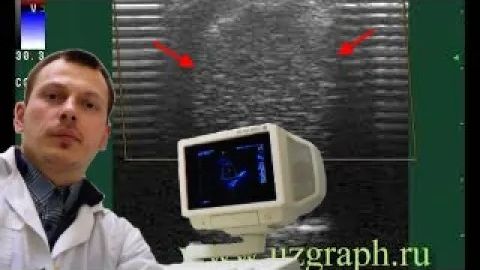 Детское УЗИ мошонки - Имплант яичка смотреть онлайн