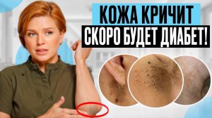 Все время устаешь САХАРНЫЙ ДИАБЕТ можно предотвратить!