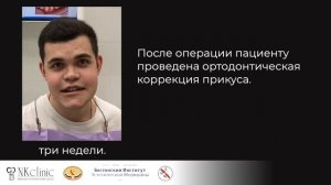 Ортогнатическая операция на челюсти. Исправление мезиального прикуса в NKclinic