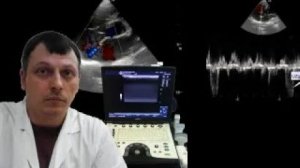 Детское УЗИ сердца (эхокардиография) - Коронарная фистула